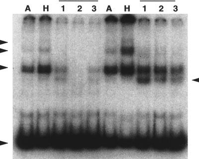 1554 In human cell lines, Ku represents the major doublestrand DNA end binding protein as detected by band shift experiments and its expression does not appear to be regulated within cell types