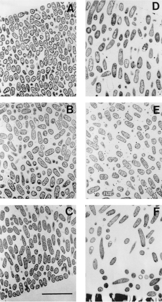 2680 NOTES ANTIMICROB. AGENTS CHEMOTHER. FIG. 1. Transmission electron micrographs of -lactamase-positive K. pneumoniae colony biofilms from the untreated 12-h control (A to C) and exposed to 1.