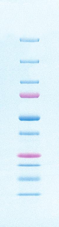 They are available in three versions: unstained, all blue, and dual color. Precision Plus Protein standards offer several advantages over traditional protein electrophoresis standards.