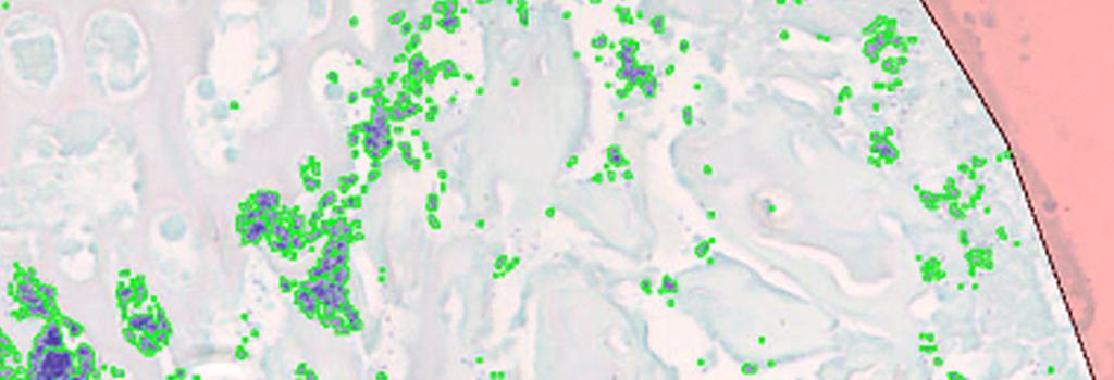 NAMSA White Paper Implant Bone tissue Bacterial contamination Figure 2. Digital segmentation of bacteria on bone tissue section after Gram- Twort staining.