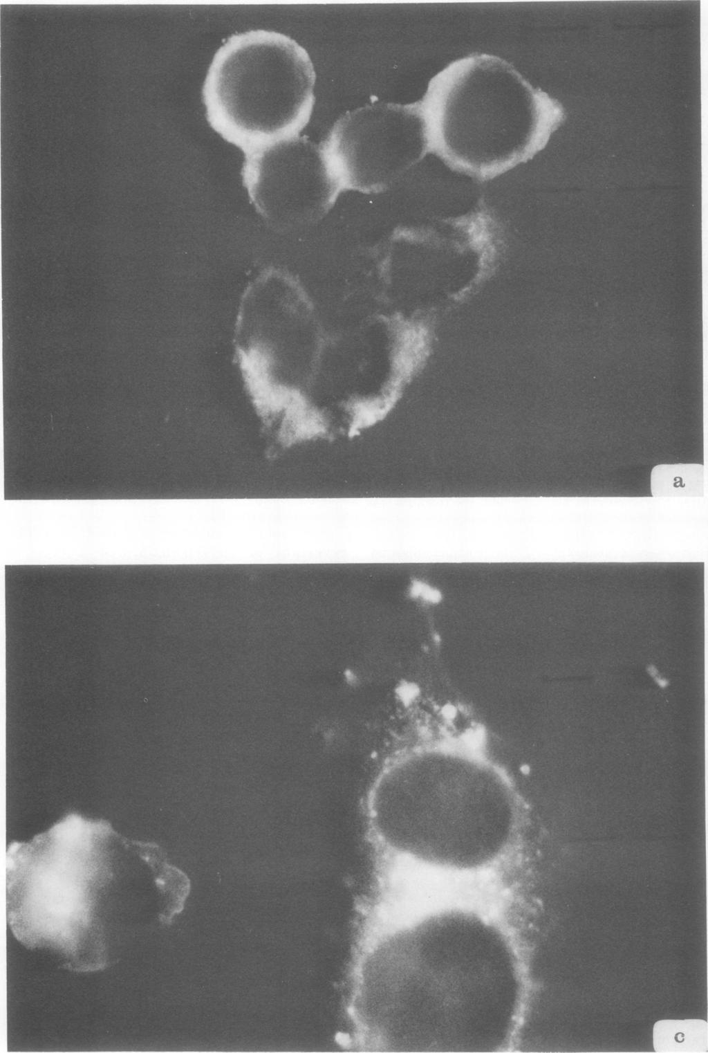 k FIG. 1. Indirect immunofluorescence test: (a) and (c) are HSV-1-transformed L and HeLa cells, respectively, stained with lytic antiserum.