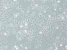 What is the transfection efficiency of Xfect Protein Transfection Reagent? The transfection efficiency of Xfect Protein Transfection Reagent can vary depending on the cell type and protein delivered.