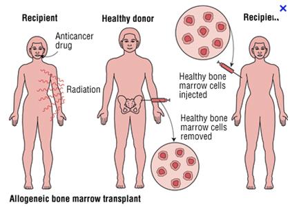 Immune monitoring for Bone Marrow