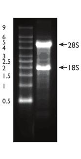 A B MW RNA 18S 28S Figure 3: Good Ribosomal RNA Band Integrity Is Important for Optimal PCR Array Results.
