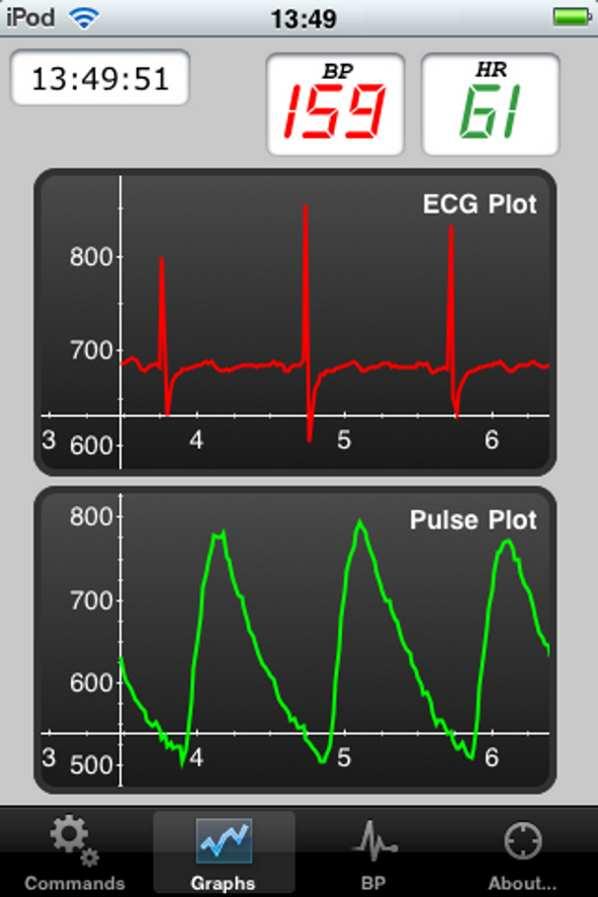 WEARABLE BLOOD PRESSURE MONITORING SYSTEM - Case Study of Multiplatform Applications for Medical Use necessary to represent the blood pressure as graphs. The BP tab is designed to address this issue.