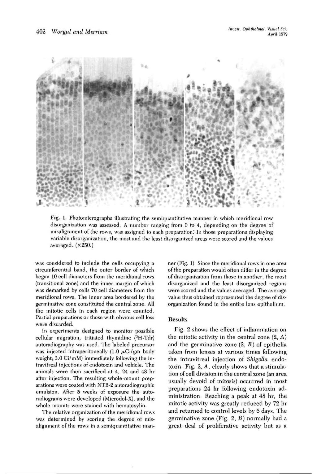 402 Worgul and Merriam Invest. Ophthalmo!. Visual Sci. April. 1979 Fig. 1. Photomicrographs illustrating the semiquantitative manner in which meridional row disorganization was assessed.