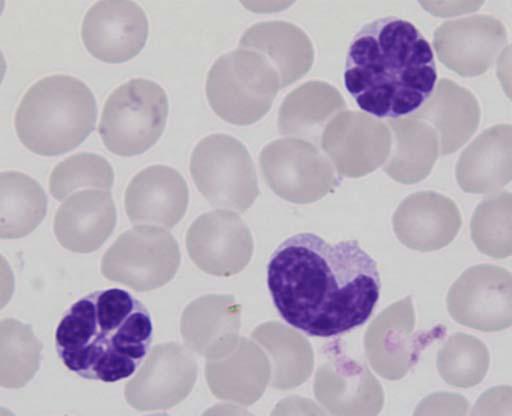 leukemia virus-1 (HTLV-1) in combination with the corresponding animal model of blood cancer associated with infection by the closely-related Bovine Leukemia virus (BLV, a virus infecting