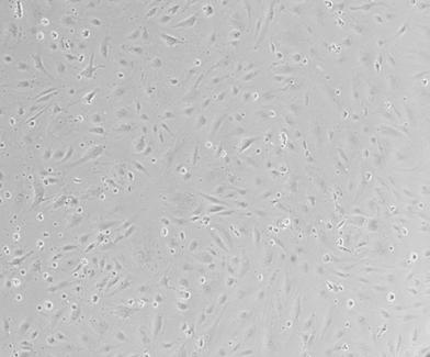 Transfection of