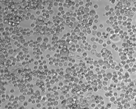 HEKPlus Expression system consistently achieves high transfection