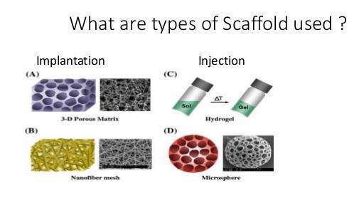 RESTRICTIONS Scaffolds in regenerative medicine are immunologically inert, biodegradable, have mechanical strength, and matrix properties.