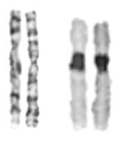 d,e Copy-number variant decrease (d) and increase (e) is detected by metaphase FISH.