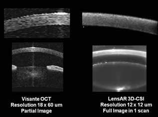 treatment laser, with sophisticated algorithms for calibration and to compensate for distortion.