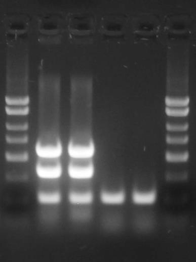 M + + - - M bp Target STX2 (587 bp) Target STX1 (348 bp) PCR con 2000 1500 1000 750 500 300 150 50 Figure 1: A representative 1X TAE, 1.4 % agarose gel showing the amplification of E.