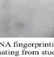 Strains containing a single copy of IS 6110 were predominant among the study population (12) and except for three, the location of the bands in fingerprints were different.