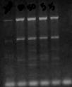 Buffer Primers DNA Taq polymerase Basics Denature- 92 0 C-95 0 C (94 0 C) Anneal-50 0 C-72 0 C Aim for 5 0 C below calculated Tm (52 0