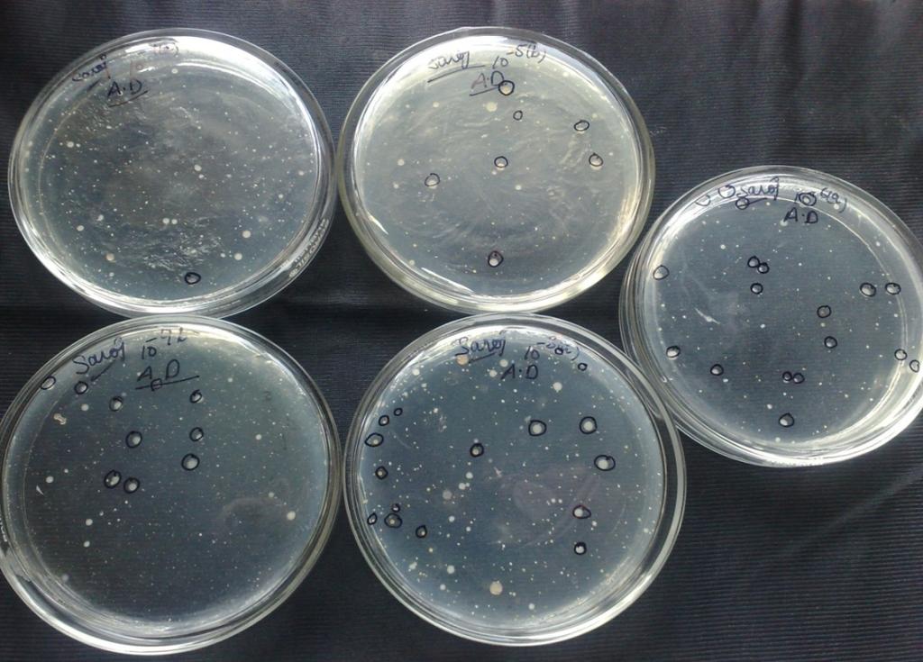 Bacterial colonies on the different