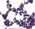 Staphylococcus aureus E.