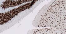 Detailed protocol: IHC for NeuN Tissue: mouse brain sections FFPE (formalin fixed paraffin embedded) Antibody: mouse anti-neun monoclonal Procedure temperature time Dewaxing Put slides in oven 60 C