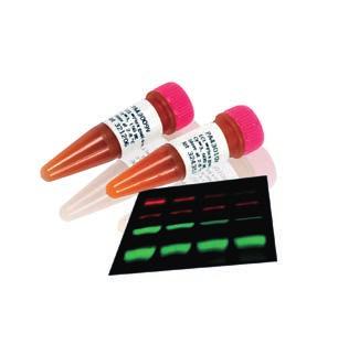 using fluorescence Western blotting Amersham ECL Western blotting detection reagents a variety of reagents, with the best choice depending on the aim of the experiment.