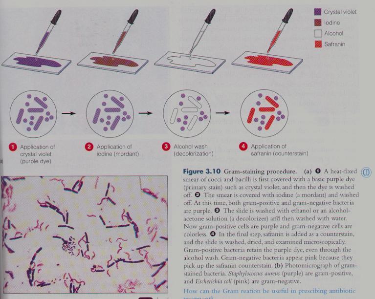 Gram Stain Based on cell wall composition and