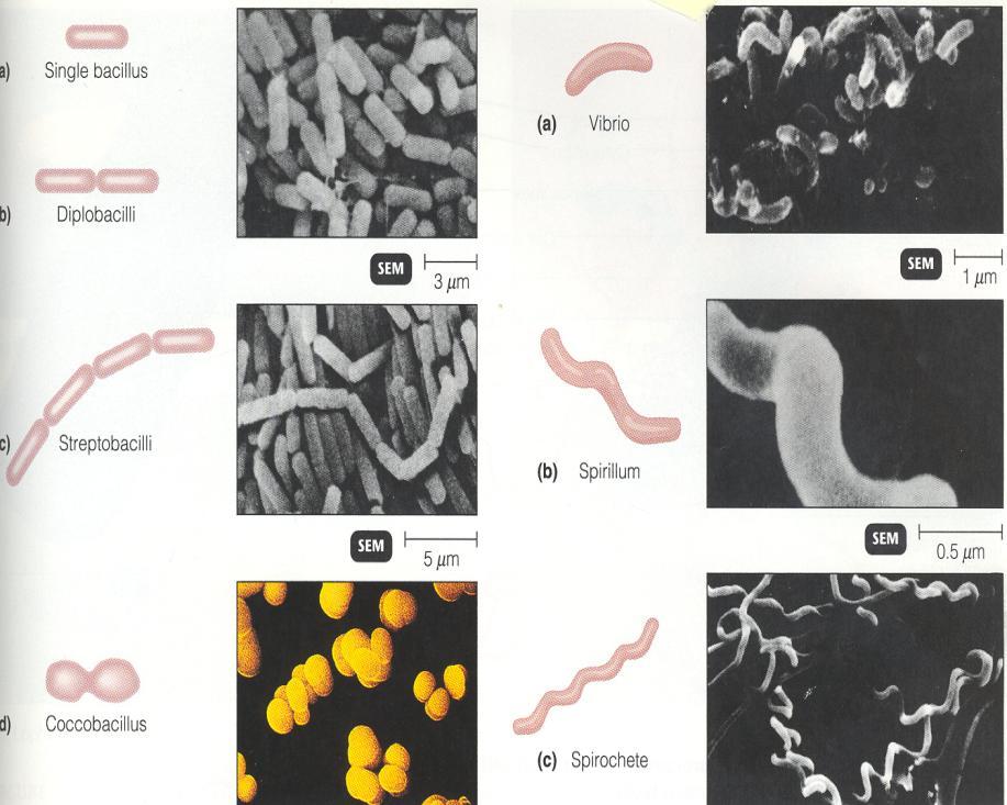 Morphologies of Bacilli Diplobacillus