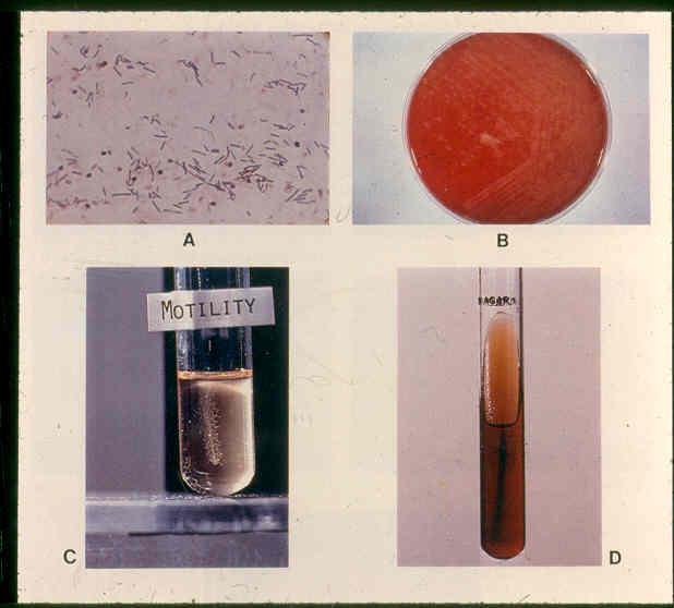 Motility Test for Flagella Motile Salmonella typhi