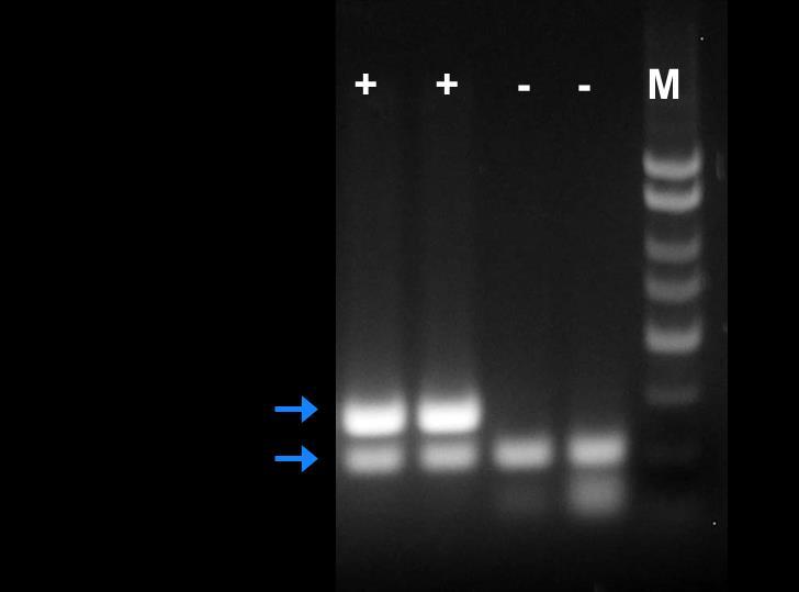 Figure 1: A representative 1X TAE, 1.4 % agarose gel showing the amplification of Chlamydia at different concentrations.