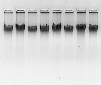 proovist koosnev DNA-pank. Võrdlusena kasutati eesti populatsiooni valimi (47 indiviidi) genotüüpide materjali, mis pärinevad eelnevalt sekveneeritud LHB/CGB geenide analüüsi andmetest (P.