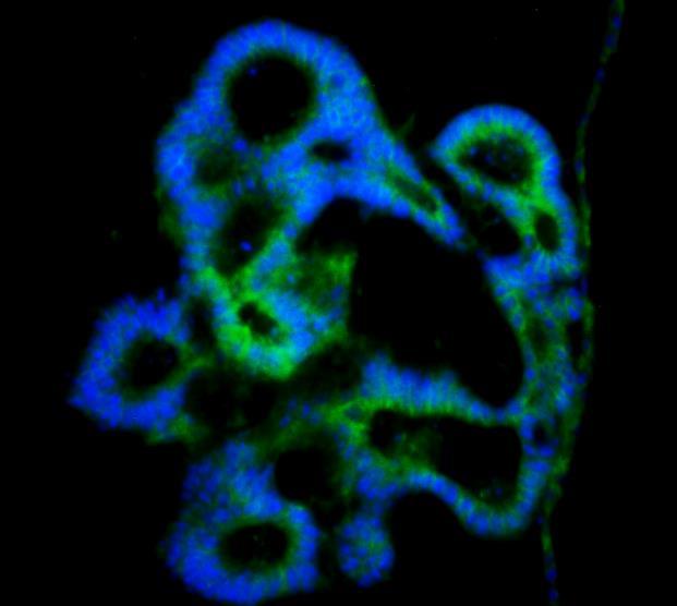 structures start to form. Immunofluorescence against herin (green) shows staining of tight-junctions.