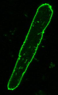 GFP is widely used as a reporter gene to monitor gene expression.