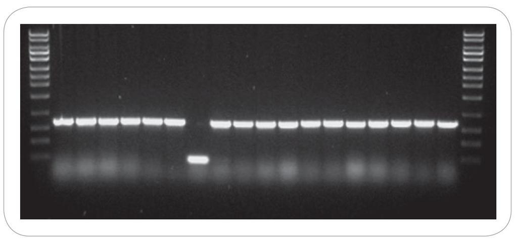 Simple Cloning and Expression Solutions Speed, Ease & High Efficiency with Expresso Cloning Simple method to clone your PCR product into a Lucigen expression vector Uses simple homologous