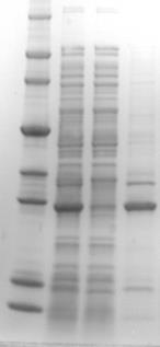 Low Recombinant Protein Solubility? Evaluation and Next Steps M T S I Analysis by SDS-PAGE: Grow E.