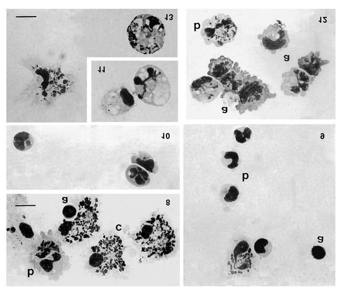 Figs 8-13 Immunocytes of M. galloprovincialis. 8) Proimmunocyte (a), Type I (b) and Type II (c) immunocytes of an adult specimen.