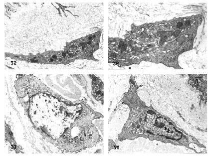 Figs 23-26 Ultrastructural aspect of the P. corneus graft capsule (96 h): RH (23); SH (24); fibroblast-like cells (25, 26). Bar = 0.
