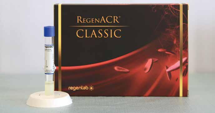 RegenACR Kit RegenACR Kit cell separator gel facilitates the easy, rapid and consistent preparation, from a small volume of blood, of A-PRP with optimal platelet concentration and viability.