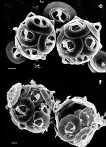 of essential metals (life is harder) For calcifying plankton, reduced calcium carbonate saturation impairs shell