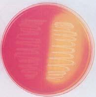 Differential and Selective Media: MacConkey Agar Selects for Gram negative and indicates if the bacterium ferments lactose Some media are both differential and selective giving you even more