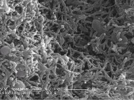 (ii) Scanning Electron microscopy (SEM):- The surface morphology of the material helps in the study of grain growth, orientation of the grains, compositional and topographical features present on the