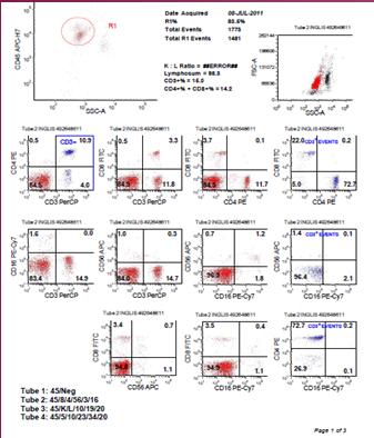 Limitations of Flow Cytometry in the Clinical Laboratory Limited role in diagnosis / follow up : Classical Hodgkins Lymphoma & variants useful exclude B or T cell disorder false negative findings