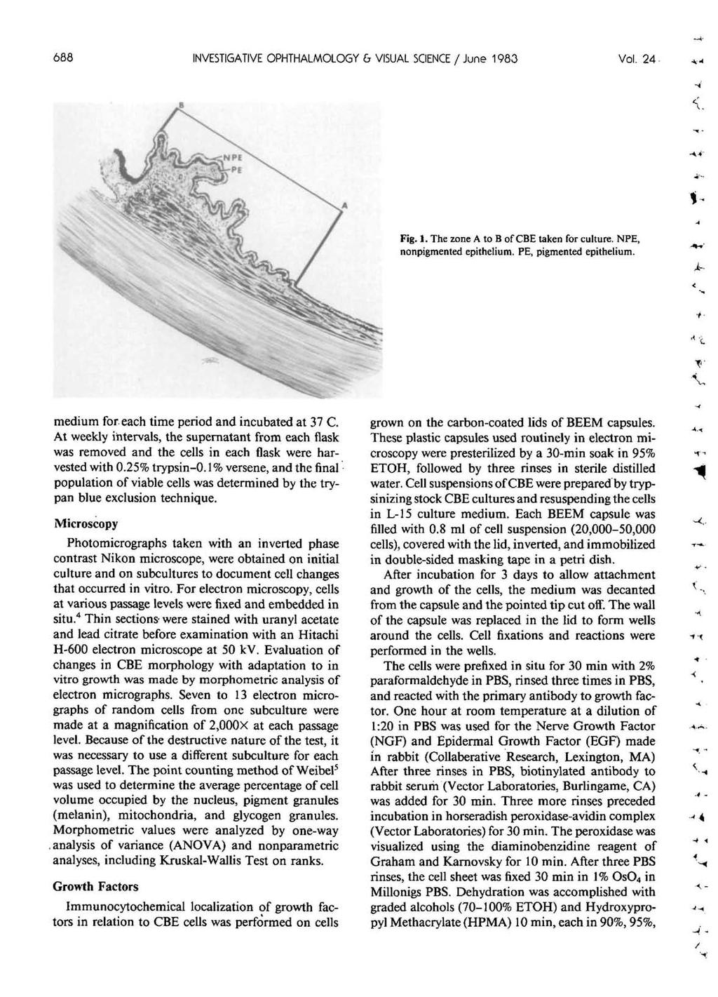 688 INVESTIGATIVE OPHTHALMOLOGY 6 VISUAL SCIENCE / June 1983 Vol. 24 Fig. 1. The zone A to B of CBE taken for culture. NPE, nonpigmented epithelium. PE, pigmented epithelium.