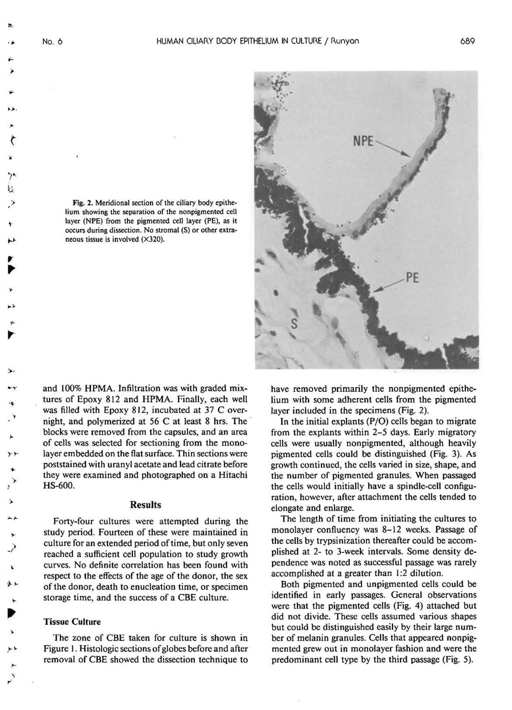 No. 6 HUMAN CILIARY BODY EPITHELIUM IN CULTURE / ftunyan 689 Fig. 2.