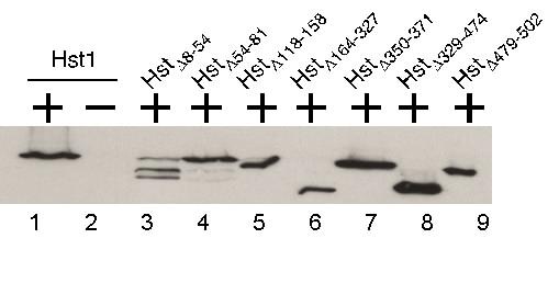 25 Western Blotting Results The results of this experiment tell us whether a specific protein is there or not.