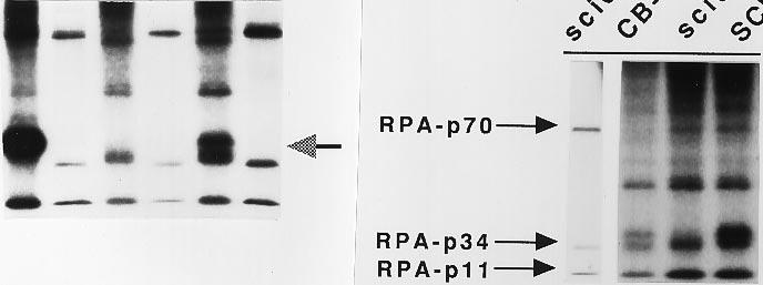 2A), it was possible that the murine scid mutation was not a null mutation for the DNA-PK kinase activity. Thus, we examined another cell line that was DNA-PK deficient.