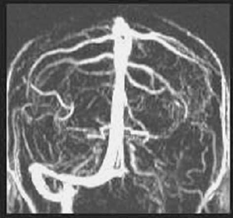 9. MR ANGIOGRAPHY 111 Top Tip!