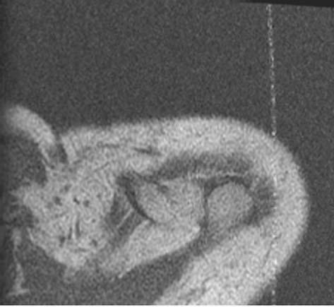 48 MRI IN CLINICAL PRACTICE This artifact is due to interference from either an external RF source (e.g.
