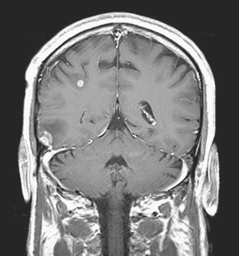68 MRI IN CLINICAL PRACTICE FIGURE 5.