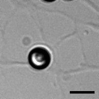 2 µm bead Pipet Neurite