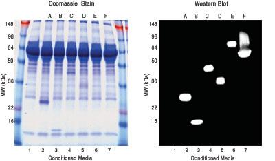 Western blotting Separate proteins by electrophoresis Transfer to membrane