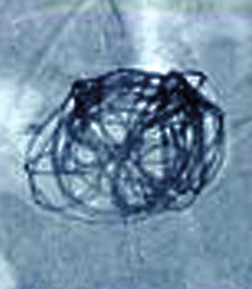 use of complex-shaped coils with a wire
