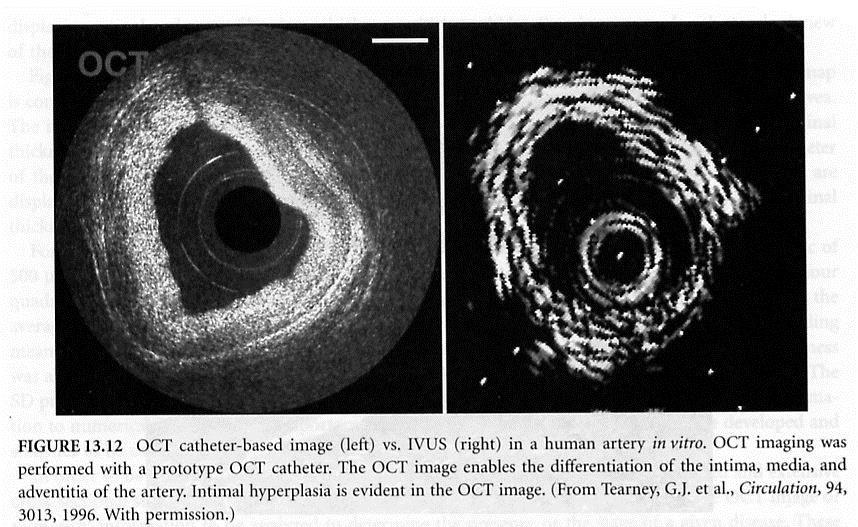 II.4 optical coherence tomography Prof.